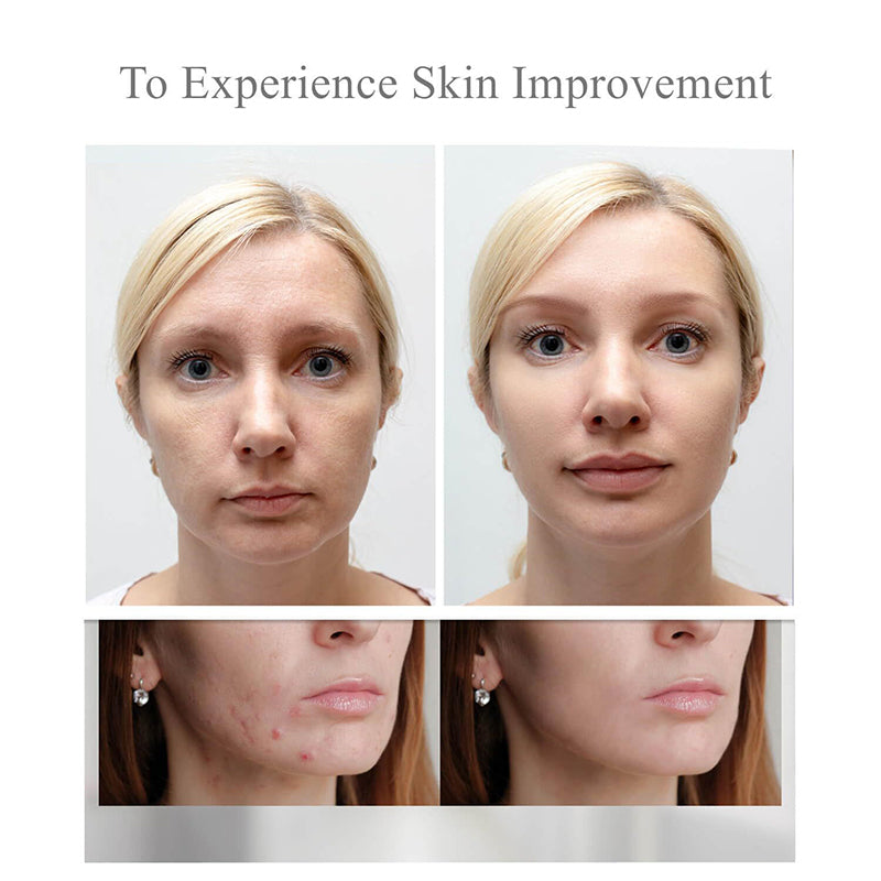 Red Light Therapy Face Mask - Model 01