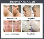 Red Light Therapy Face Mask - Model 09