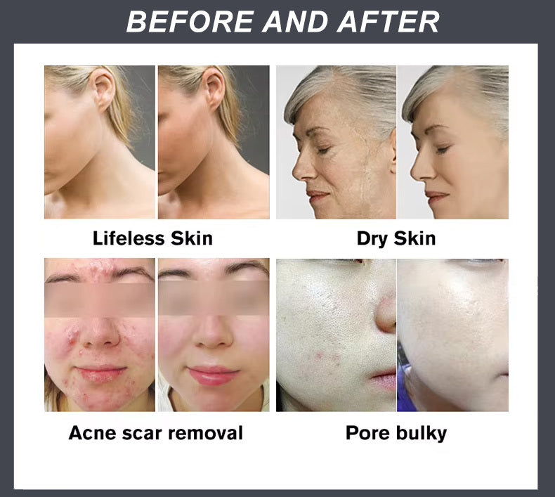 MASK 1 WITH MAT MultiPurpose Silicone LED Therapy Mask 1